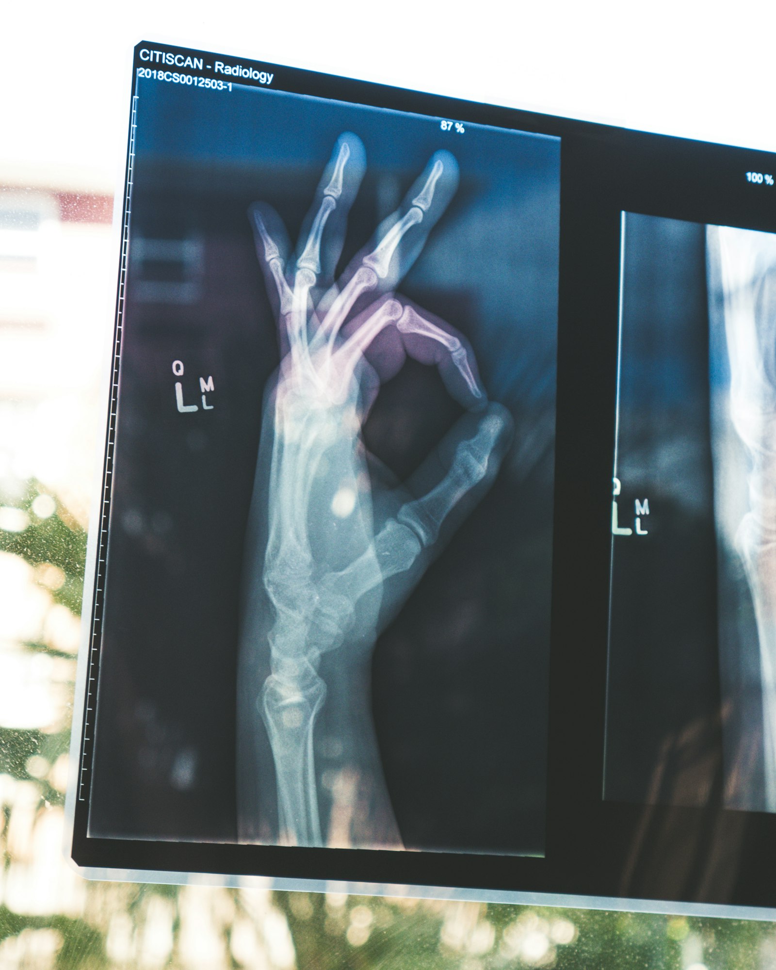 Consulta de Traumatología online